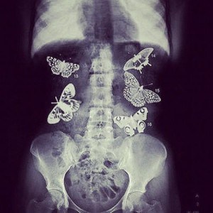 Papillons dans le ventre